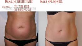 MASAJE REDUCTIVO EN MAYA SPA MERIDA